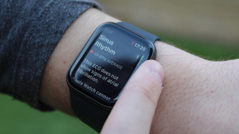 Приложение Apple Watch ECG: что это такое, как работает и насколько точно?
