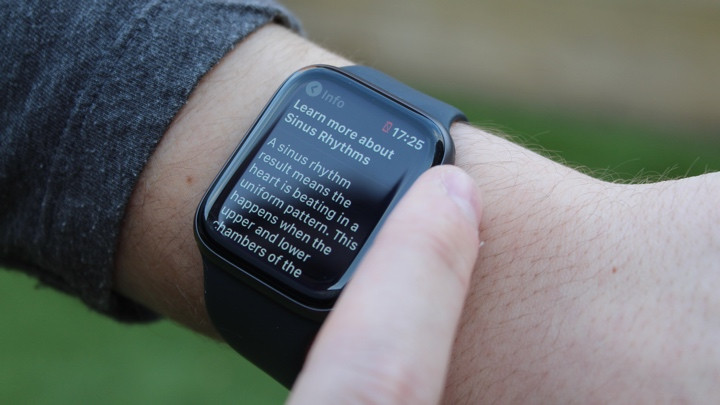Приложение Apple Watch ECG: что это такое, как работает и насколько точно?